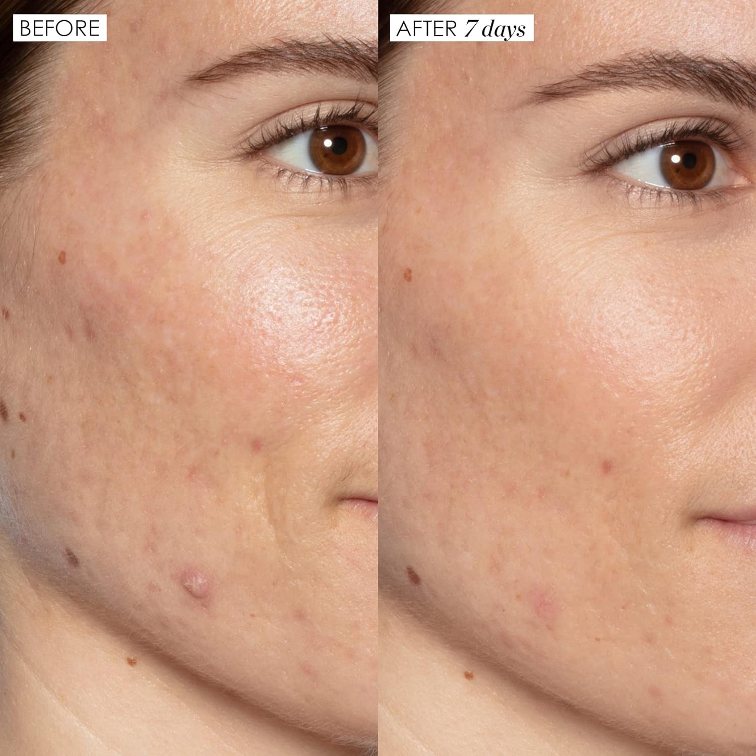 Good Genes All-In-One Lactic Acid Treatment Face Serum