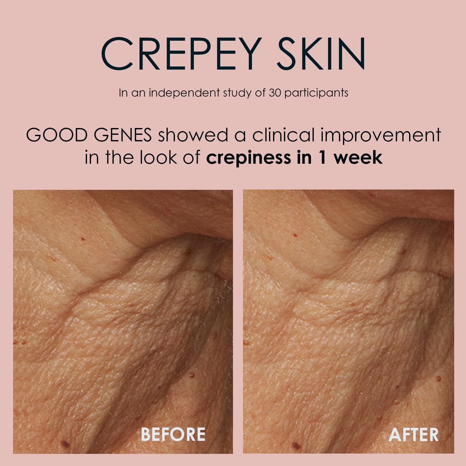 Good Genes All-In-One Lactic Acid Treatment Face Serum