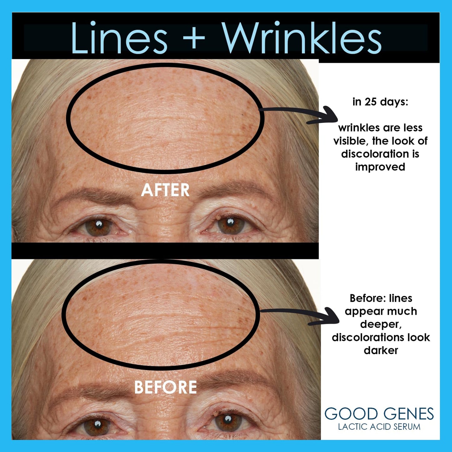 Good Genes All-In-One Lactic Acid Treatment Face Serum