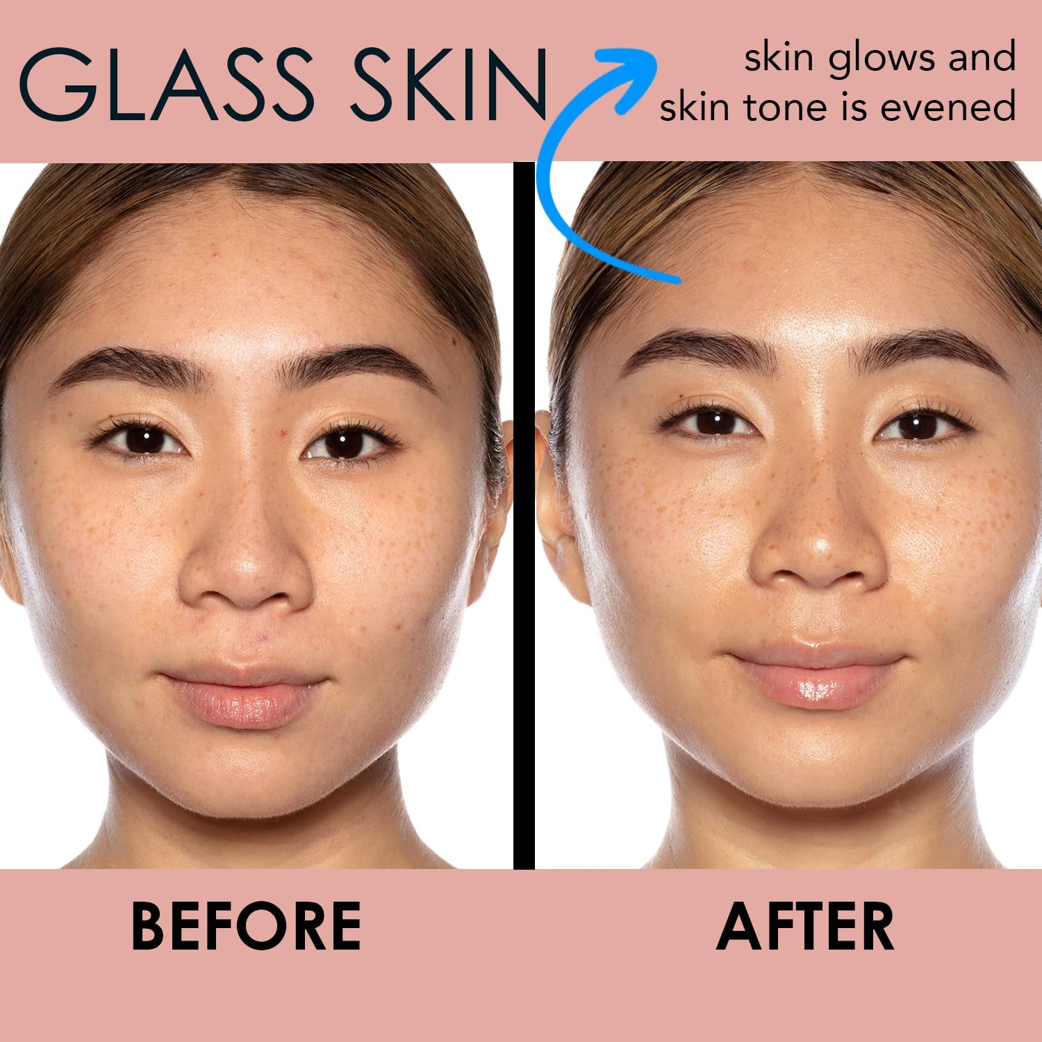Good Genes All-In-One Lactic Acid Treatment Face Serum